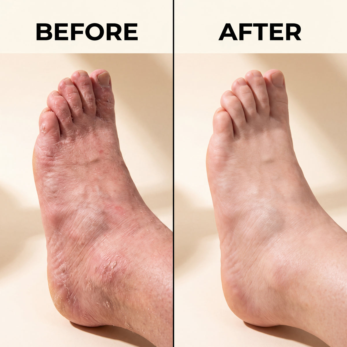 Anti-Fungal Skin Soap